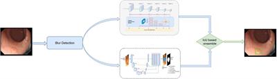 A Machine Learning-Based System for Real-Time Polyp Detection (DeFrame): A Retrospective Study